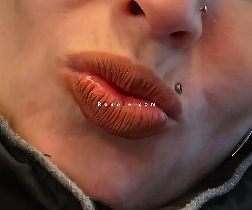 Femmes pour felassion #1